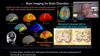 Hongtu Zhu (University of North Carolina) describes image analysis methods for better understanding brain disorders.