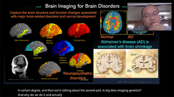 Hongtu Zhu (University of North Carolina) describes image analysis methods for better understanding brain disorders. Hongtu Zhu (University of North Carolina) describes image analysis methods for better understanding brain disorders.