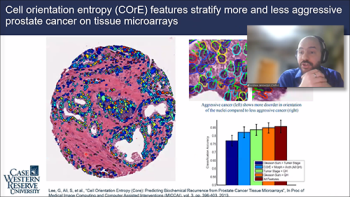 Andrew Janowczyk, (Case Western) describes an example of tissue analysis of prostate cancer.